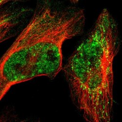 TRMT12 Antibody, Novus Biologicals 25 &mu;L; Unlabeled:Antibodies, Polyclonal